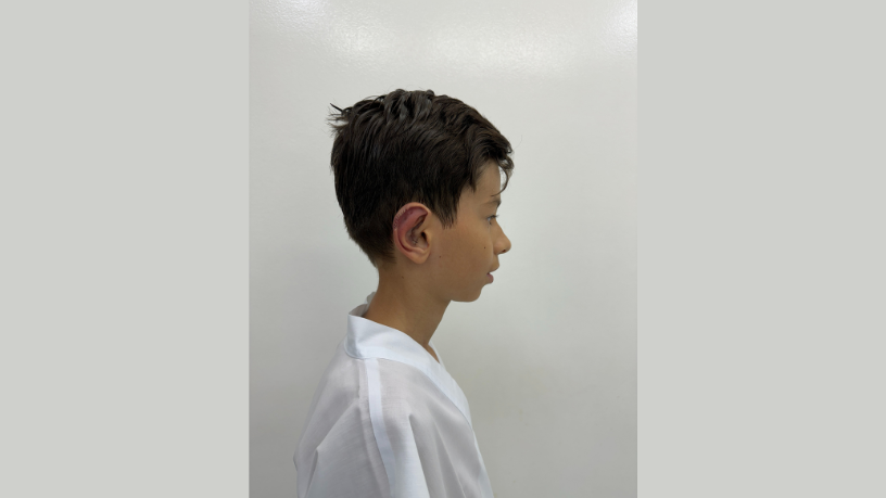 Descubra com Milton Seigi Hayashi como a cirurgia de orelhas pode redefinir a percepção de beleza.